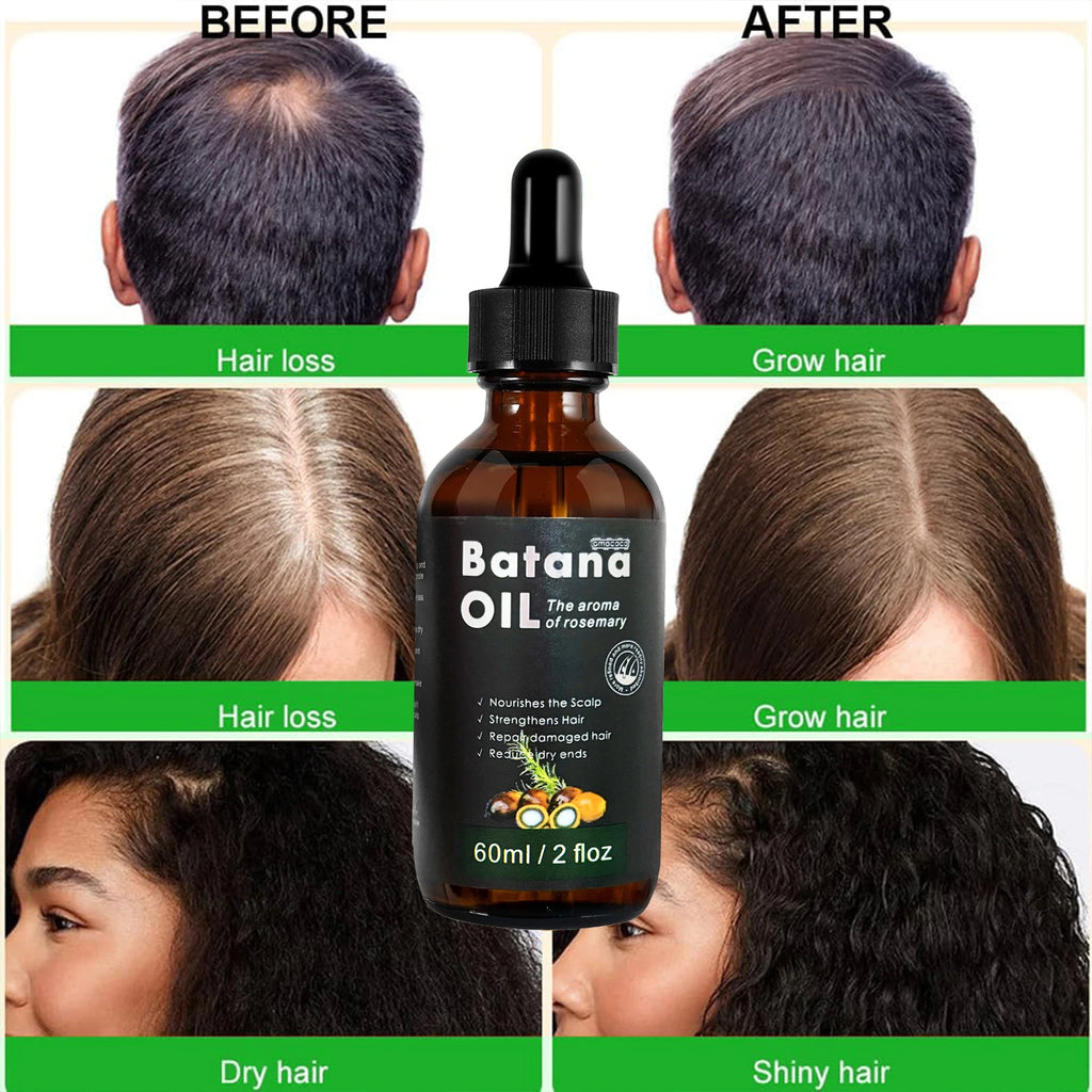 Peauti Batana & Rosemary Hair Strengthening + Scalp Nourishing Oil Set