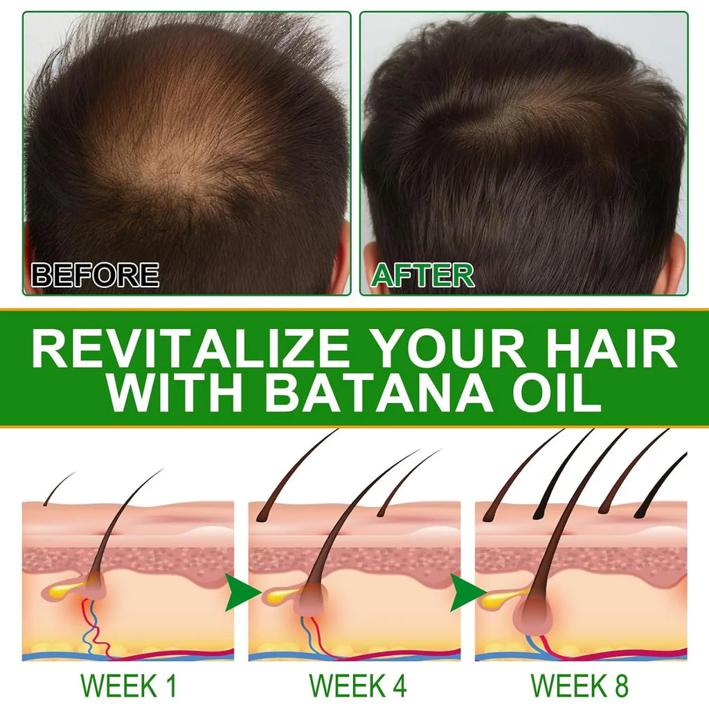 Peauti Batana & Rosemary Hair Strengthening + Scalp Nourishing Oil Set