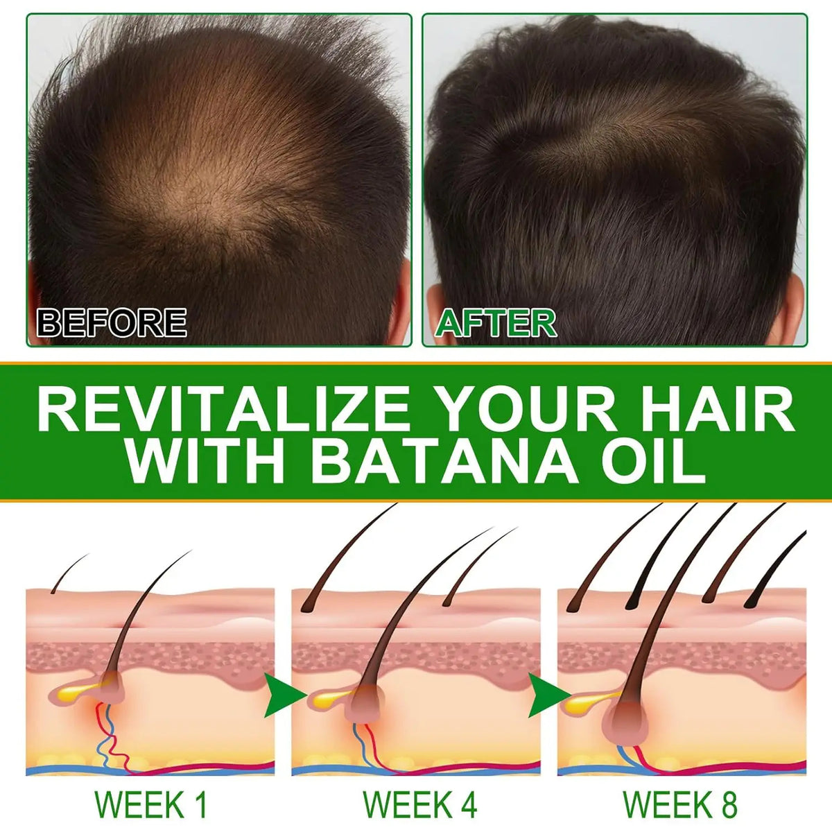 Peauti Batana & Rosemary Hair Strengthening + Scalp Nourishing Oil Set